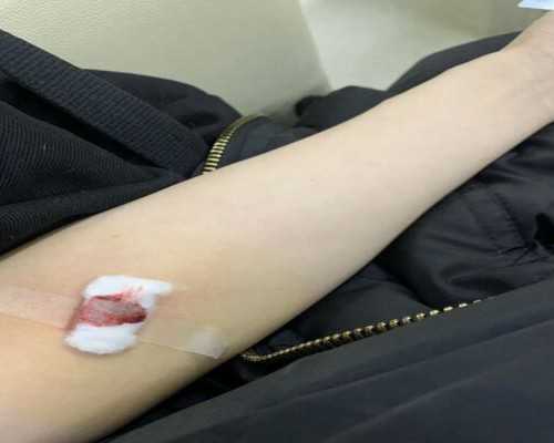 国内合作供卵,*内膜多少是薄？试管移植还有希望吗?